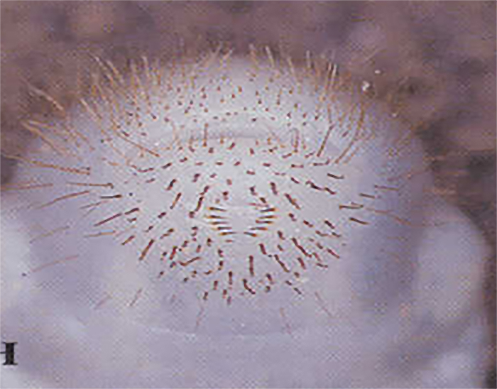 Patr&oacute;n de pelos en forma de &ldquo;V&rdquo; en la regi&oacute;n anal de la larva del escarabajo japon&eacute;s.&nbsp;